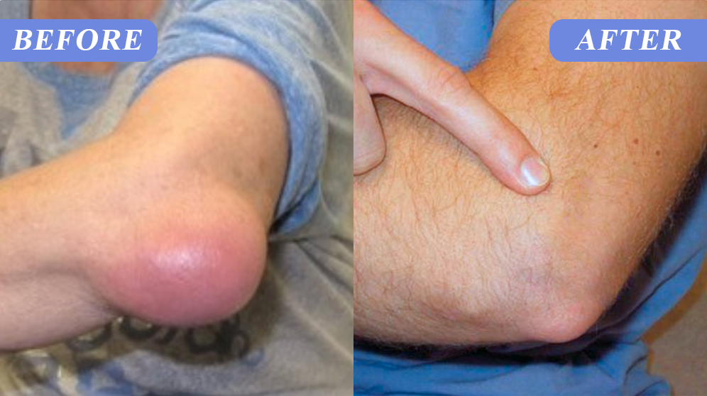 ATTDX® BPC-157 TriMag Complex Joint Therapy Cream image ATTDX® BPC-157 TriMag Complex Joint Therapy Cream