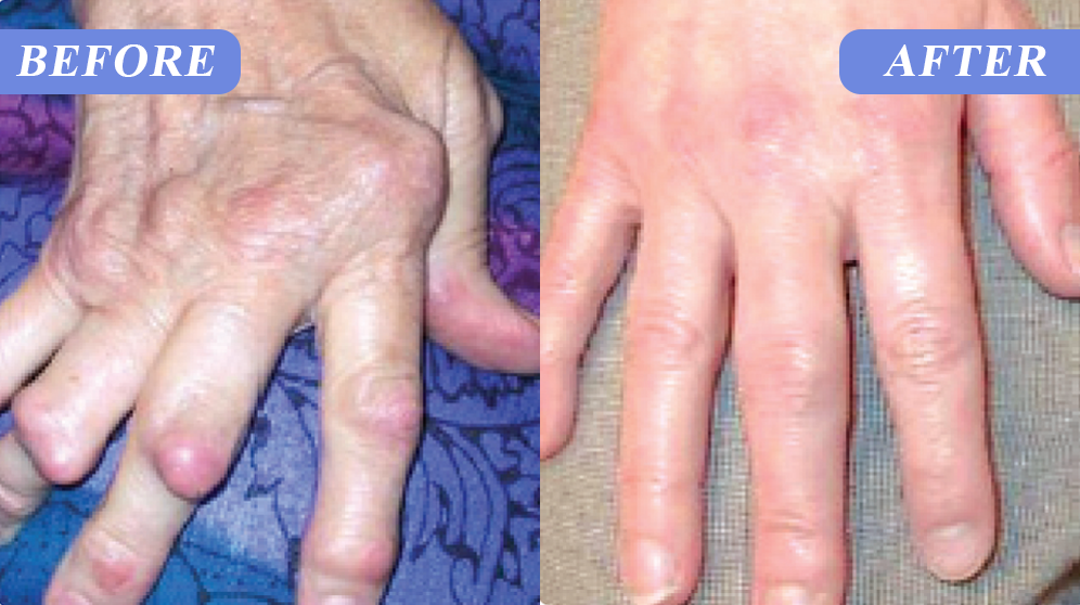 ATTDX® BPC-157 TriMag Complex Joint Therapy Cream image ATTDX® BPC-157 TriMag Complex Joint Therapy Cream