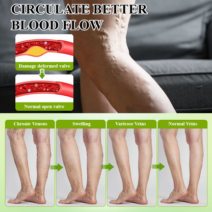 ATTDX® Fluid Regulation Edema Care Cream