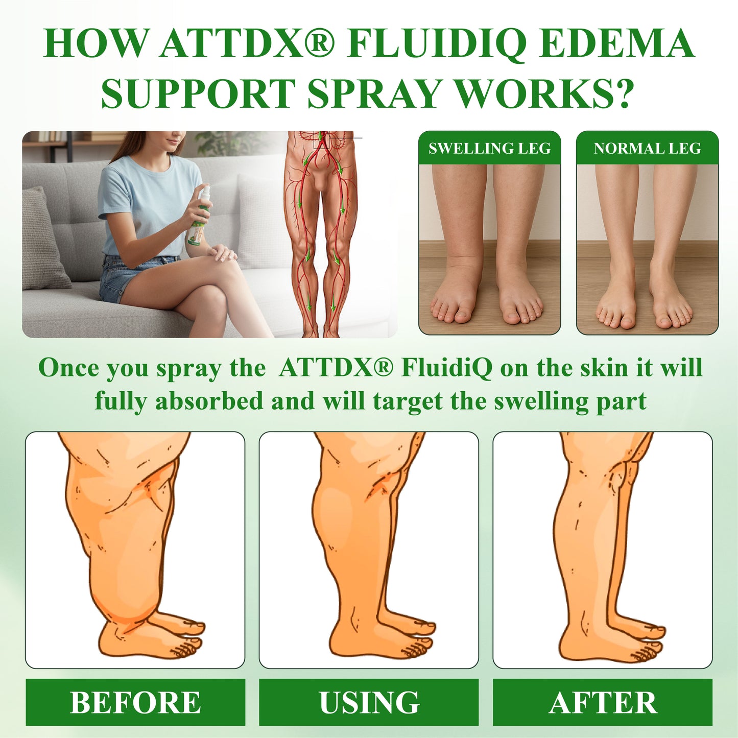 ATTDX® FluidiQ Edema Support Spray
