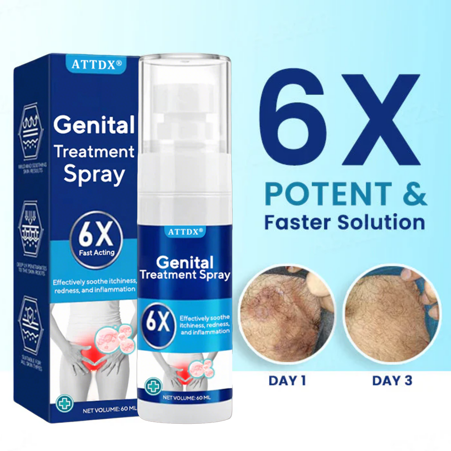 ATTDX® Genital Treatment Spray