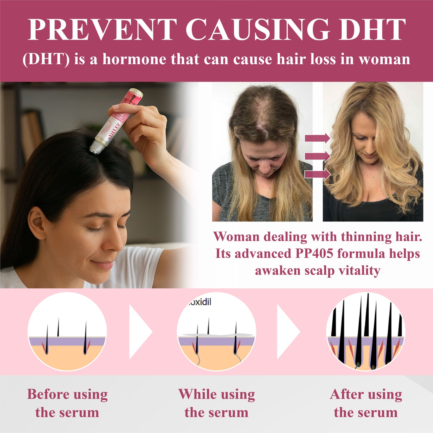 ATTDX® Hair Reawaken PP405 Roll-On Serum for Women 👩