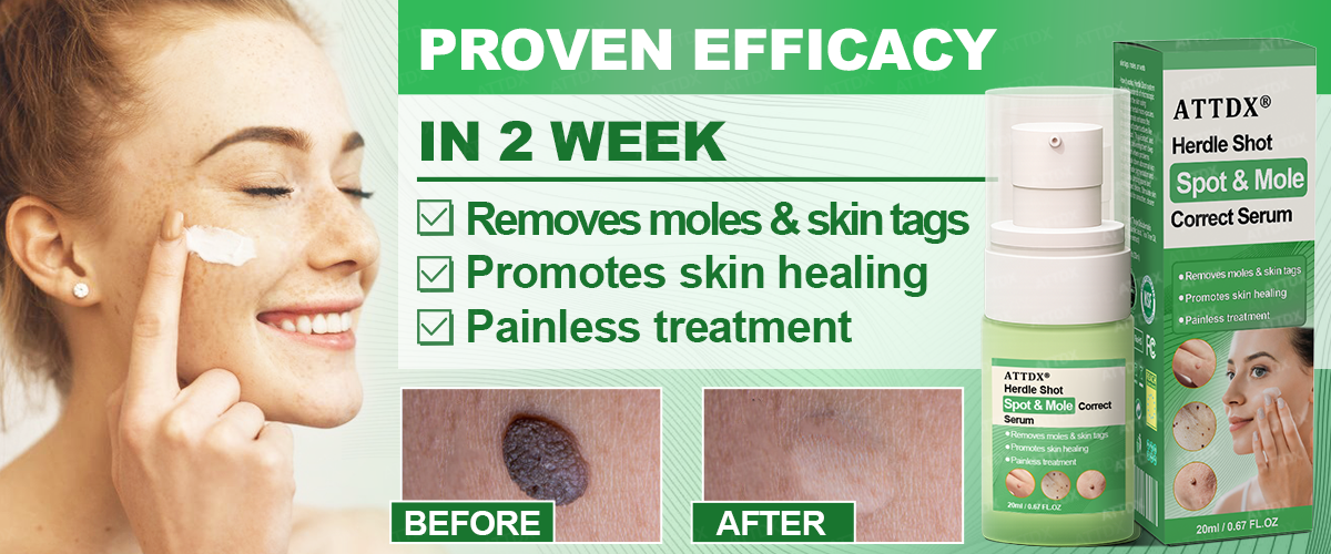 ATTDX® Herdle Shot Spot & Mole Correct Serum 26 ATTDX® Herdle Shot Spot & Mole Correct Serum