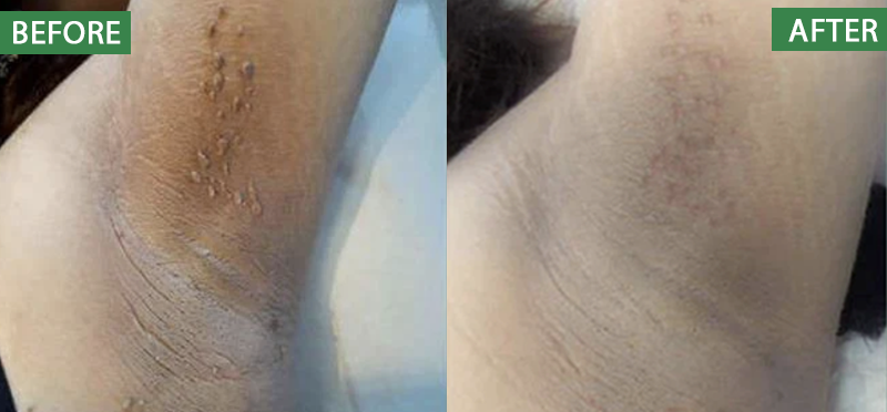 ATTDX® Herdle Shot Spot & Mole Correct Serum 28 ATTDX® Herdle Shot Spot & Mole Correct Serum