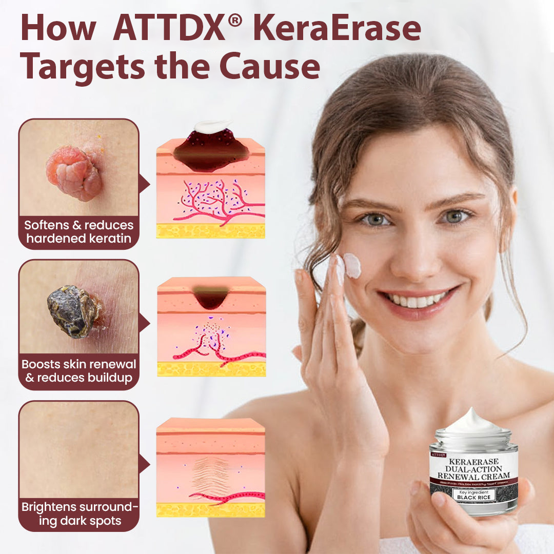 ATTDX® KeraErase Dual-Action Renewal Cream 2