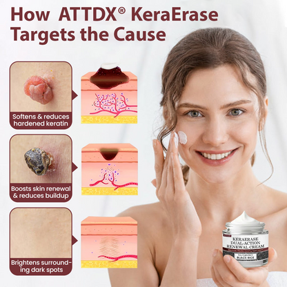 ATTDX® KeraErase Dual-Action Renewal Cream 2