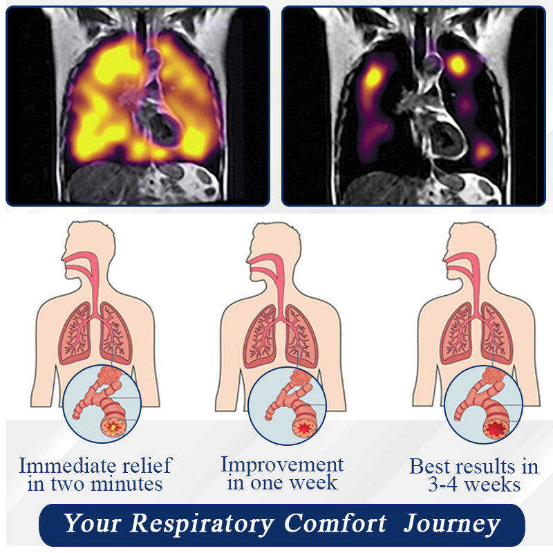 ATTDX® LungPurify NDIS Herbal Detox Patch