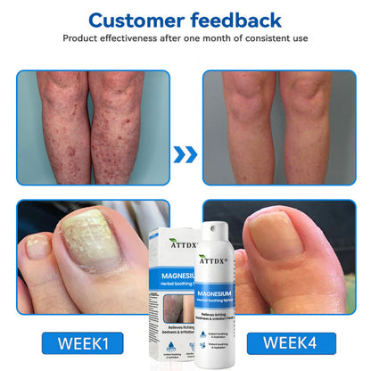 ATTDX® Magnesium Herbal Soothing Spray 👨‍⚕️ MHRA Approved