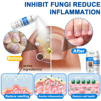 ATTDX® Magnesium Herbal Soothing Spray 👨‍⚕️ MHRA Approved