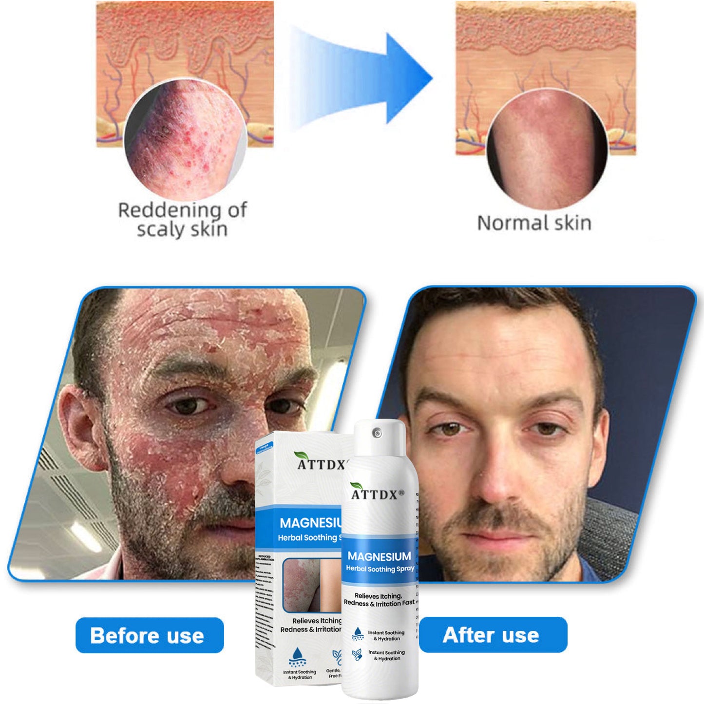 ATTDX® Magnesium Herbal Soothing Spray 👨‍⚕️ MHRA Approved