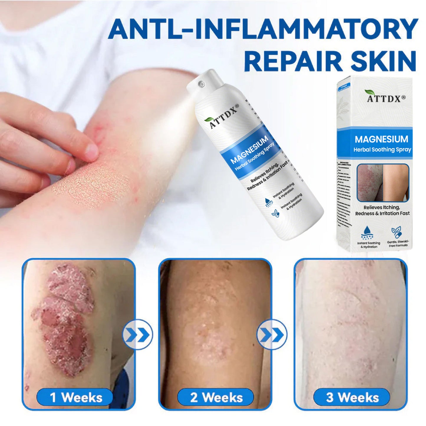 ATTDX® Magnesium Herbal Soothing Spray 👨‍⚕️ MHRA Approved