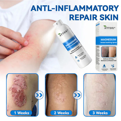 ATTDX® Magnesium Herbal Soothing Spray 👨‍⚕️ MHRA Approved