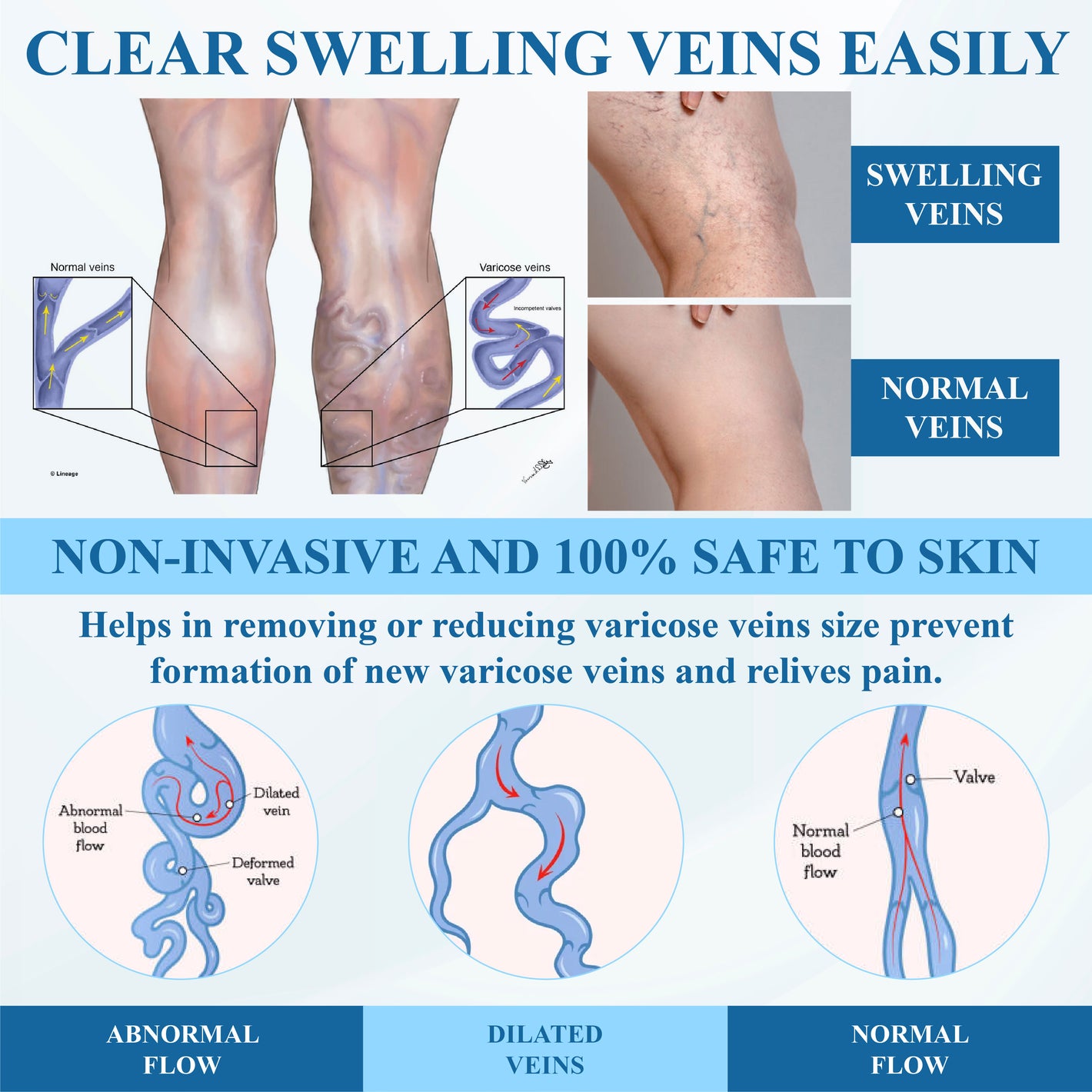 ATTDX® MagniLift VeinErase Spray 29 ATTDX® MagniLift VeinErase Spray