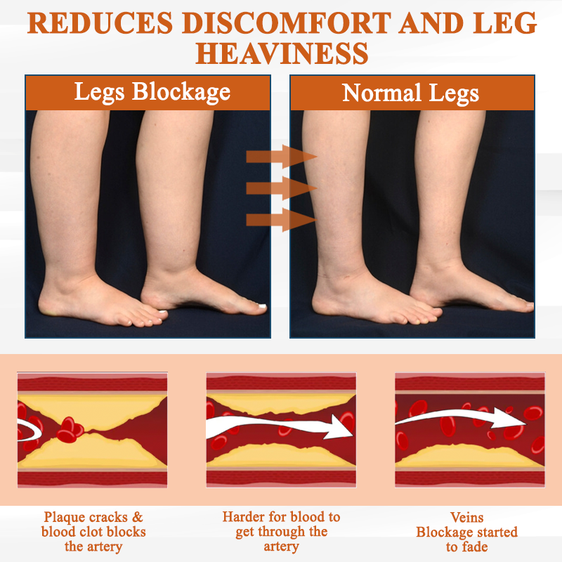 ATTDX® ManukaRelief Edema Therapy Cream 30 ATTDX® ManukaRelief Edema Therapy Cream