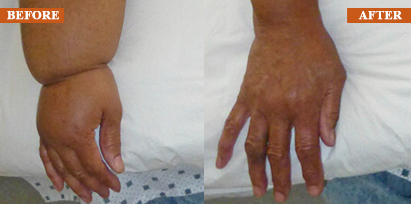 ATTDX® ManukaRelief Edema Therapy Cream 29 ATTDX® ManukaRelief Edema Therapy Cream