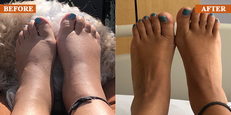 ATTDX® ManukaRelief Edema Therapy Cream 27 ATTDX® ManukaRelief Edema Therapy Cream