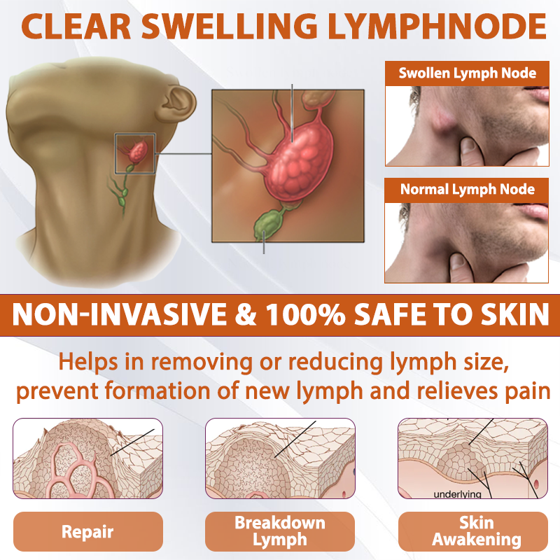 ATTDX® ManukaRelief Edema Therapy Cream 33 ATTDX® ManukaRelief Edema Therapy Cream