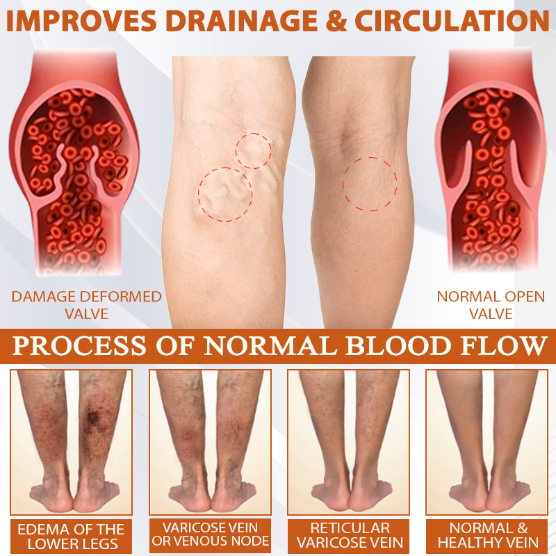 ATTDX® ManukaRelief Edema Therapy Cream 31 ATTDX® ManukaRelief Edema Therapy Cream