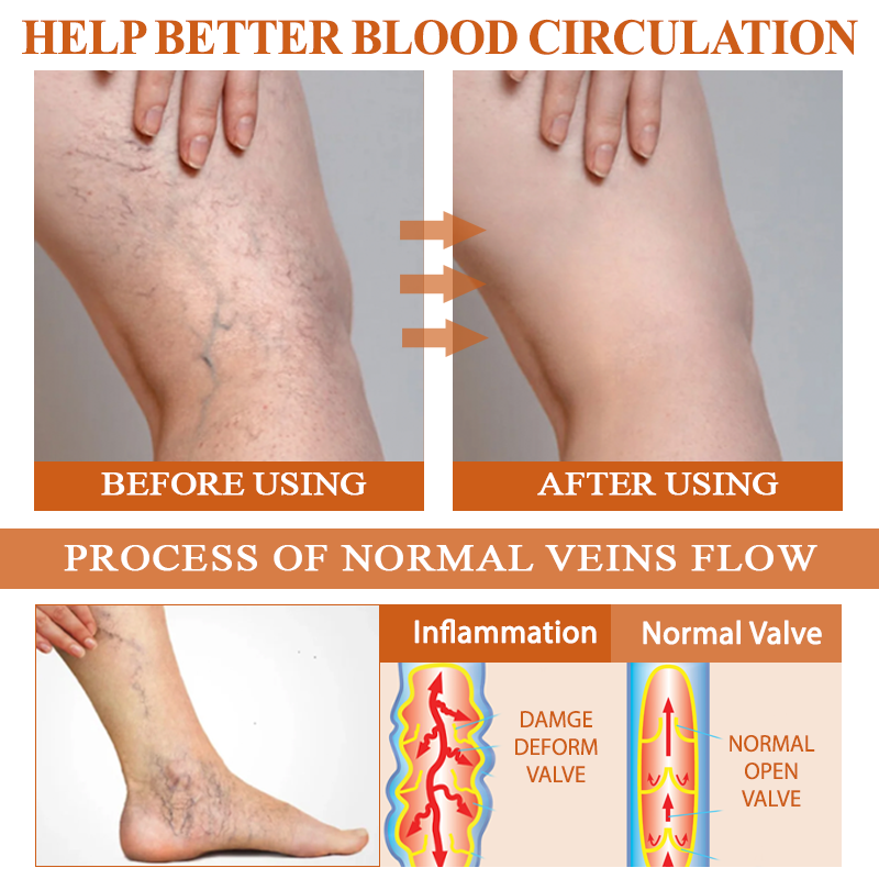 ATTDX® ManukaRelief Edema Therapy Cream