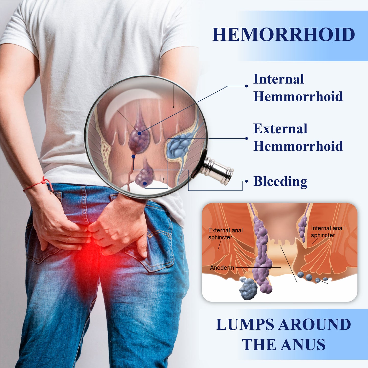 ATTDX® Medical Hemorrhoid Herbal Gel with Applicator