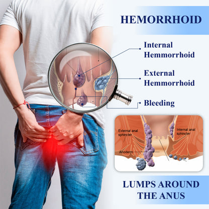 ATTDX® Medical Hemorrhoid Herbal Gel with Applicator