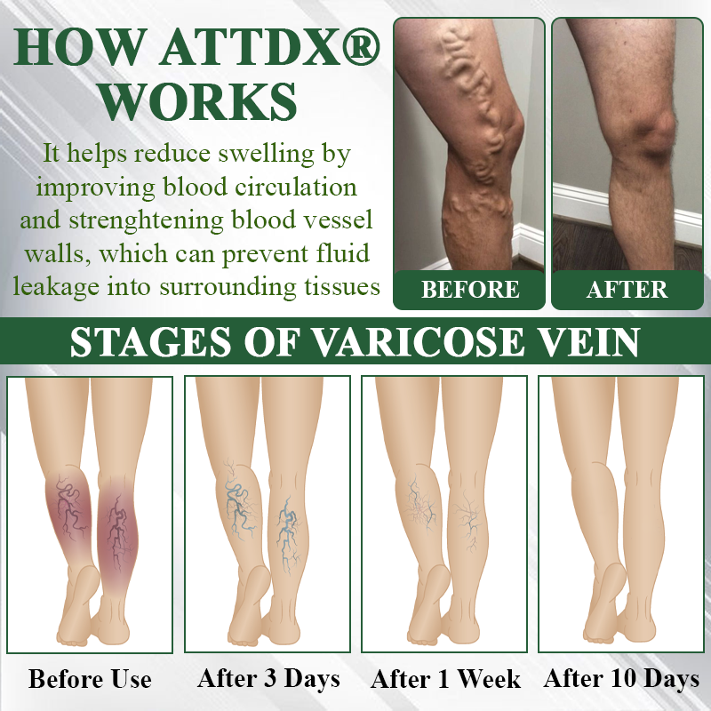 ATTDX® MicroDrain Edema Relief Microneedle Patch