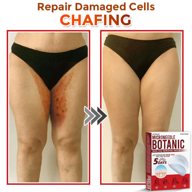 ATTDX® MicroNeedle Botanic Skin Tag Removal Patch
