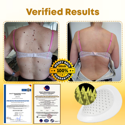 MoleClear Microneedle BeeVenom Patch