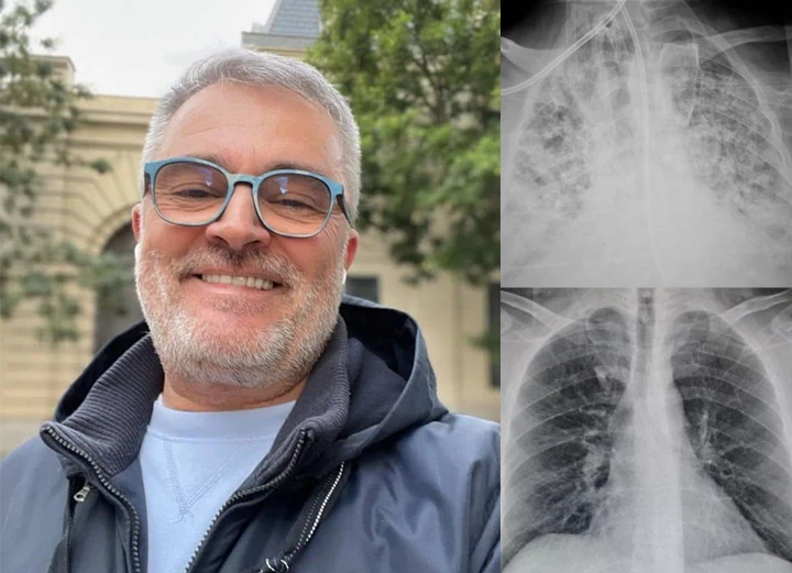 ATTDX Mulleaf Herbal Lung Purifier com review1