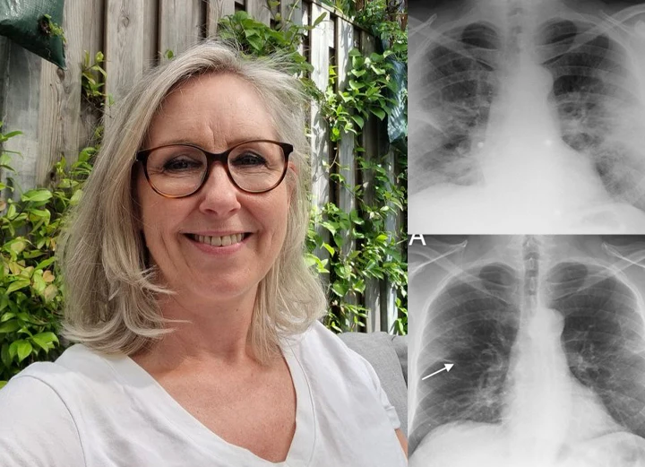 ATTDX Mulleaf Herbal Lung Purifier com review2