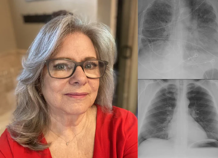 ATTDX Mulleaf Herbal Lung Purifier com review3