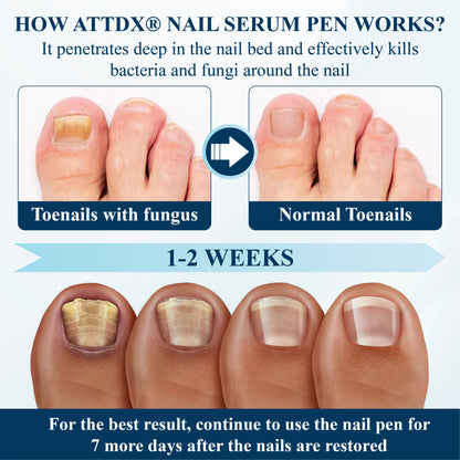 ATTDX® MycoStop Nail Recovery Serum Pen