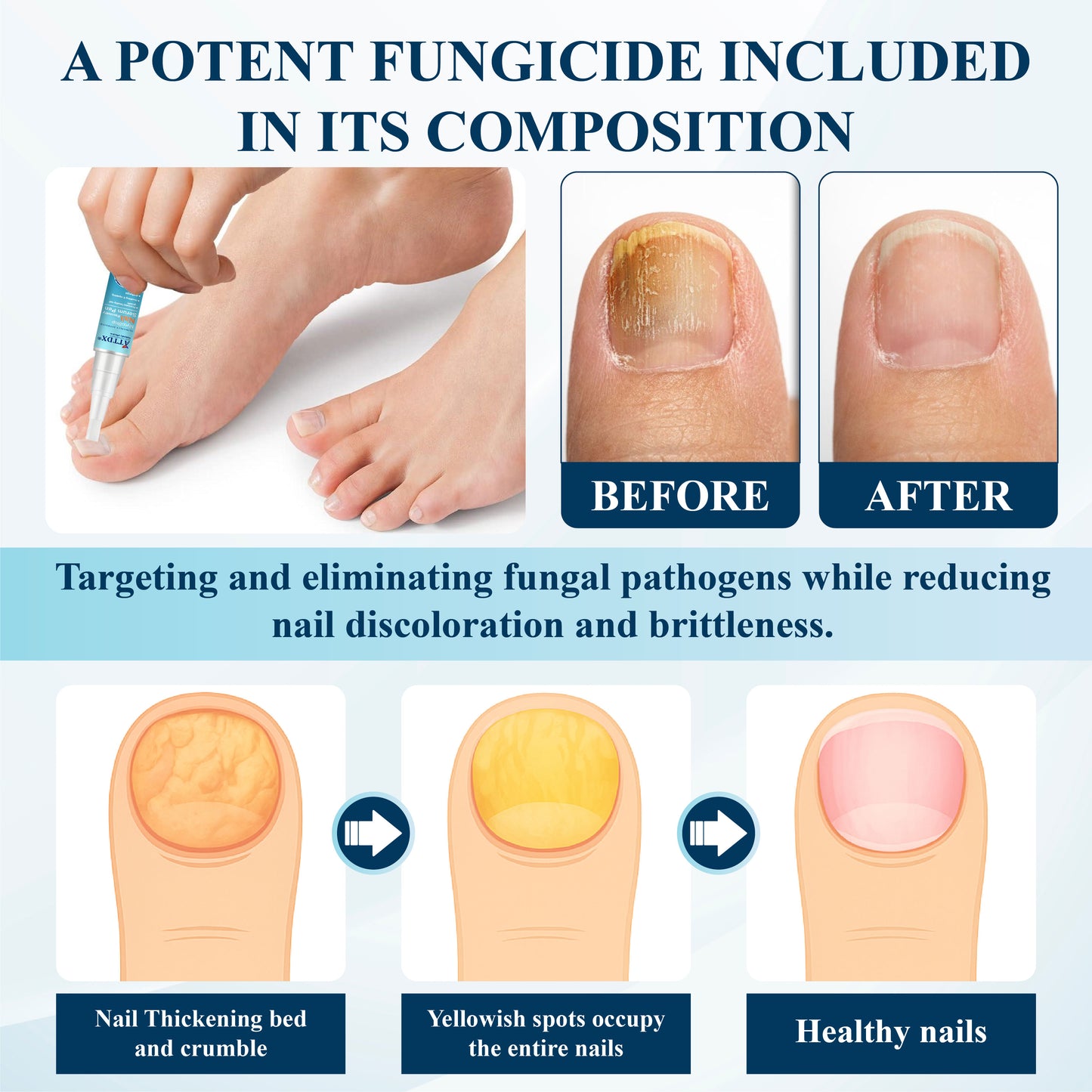 ATTDX® MycoStop Nail Recovery Serum Pen