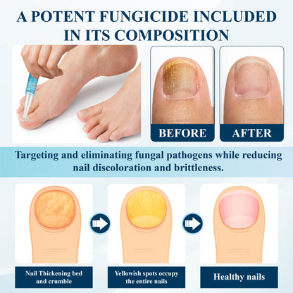 ATTDX® MycoStop Nail Recovery Serum Pen