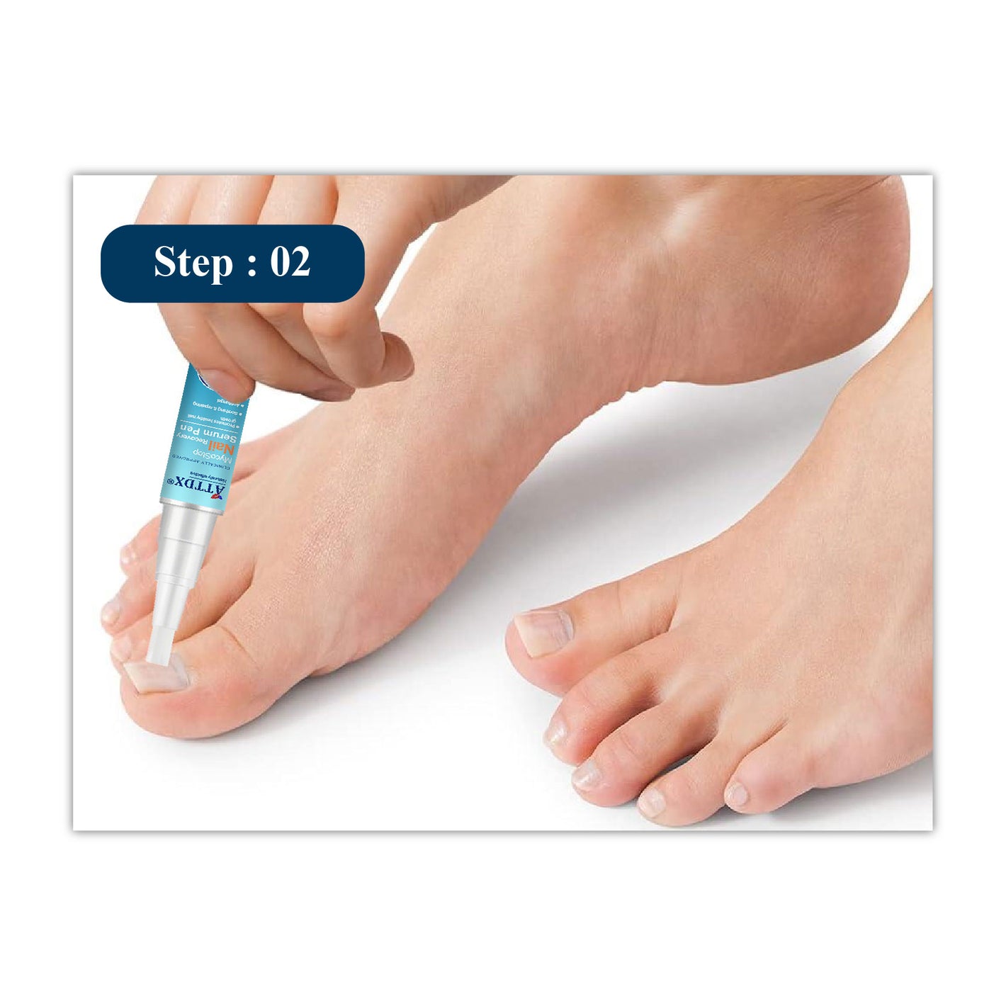ATTDX MycoStop Nail Recovery Serum Pen 12