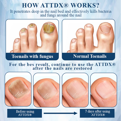 ATTDX® MycoStop Nail Recovery Serum Pen