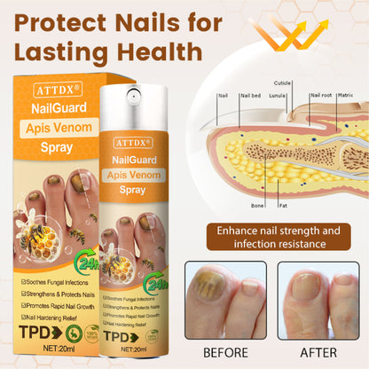 ATTDX® NailGuard Apis Venom Spray