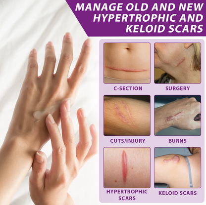 ATTDX® ClearScar Advanced Therapy Spray