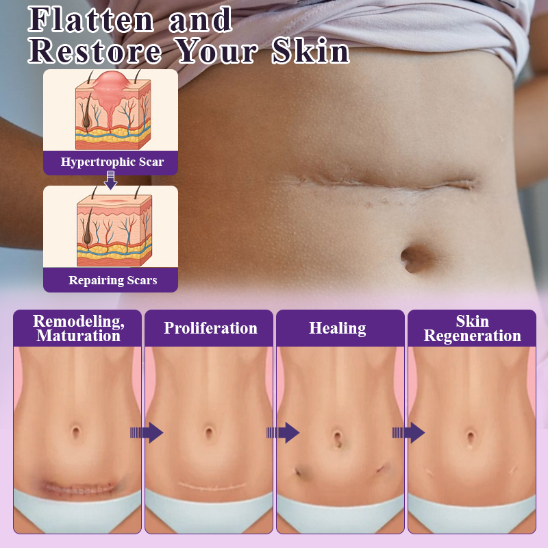 ATTDX® NanoHeal Advanced Face & Body Scar Gel image ATTDX® NanoHeal Advanced Face & Body Scar Gel