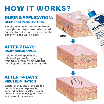 ATTDX® NanoLipo HPV Genital Warts Eraser Cream