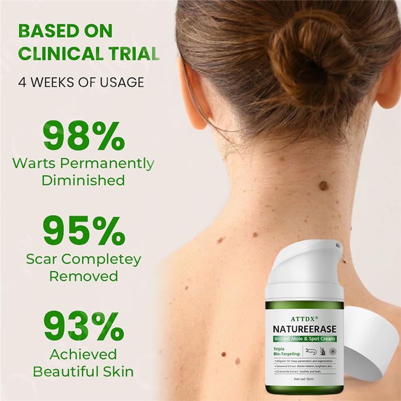 ATTDX® NatureErase Instant Alligator Oil Mole & Spot Cream