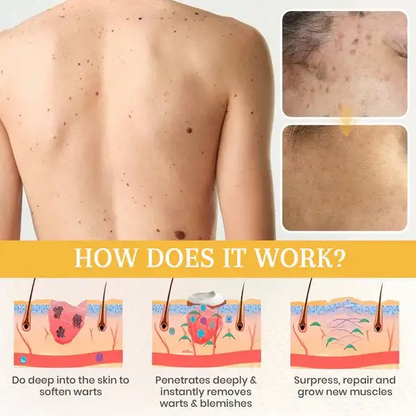 ATTDX® NatureStore Instant Mole & Spot Cream