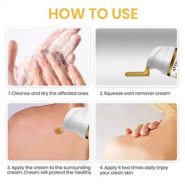 ATTDX® NatureStore Instant Mole & Spot Cream