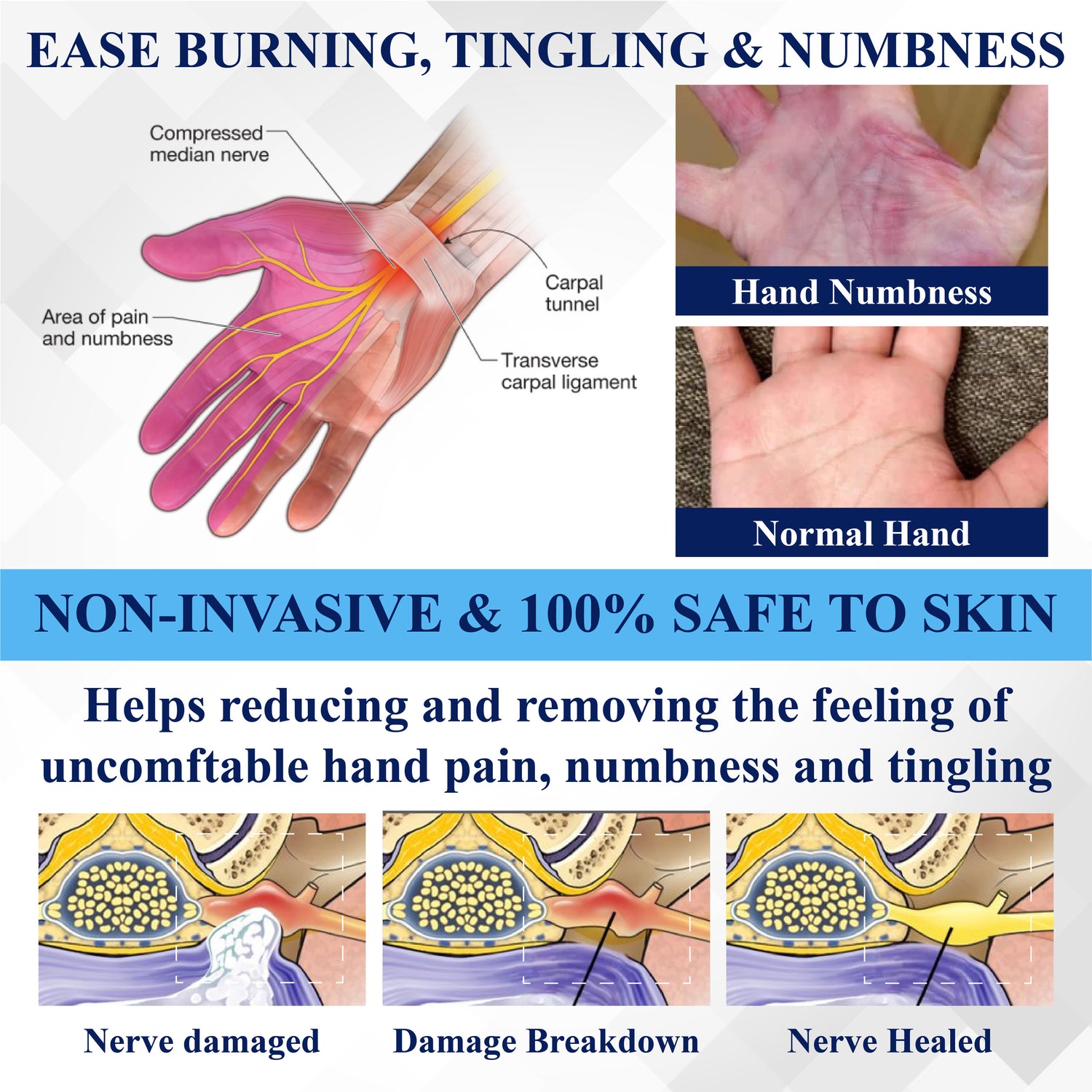 ATTDX® NerveRelief LC Medical Treatment Cream 20 ATTDX® NerveRelief LC Medical Treatment Cream