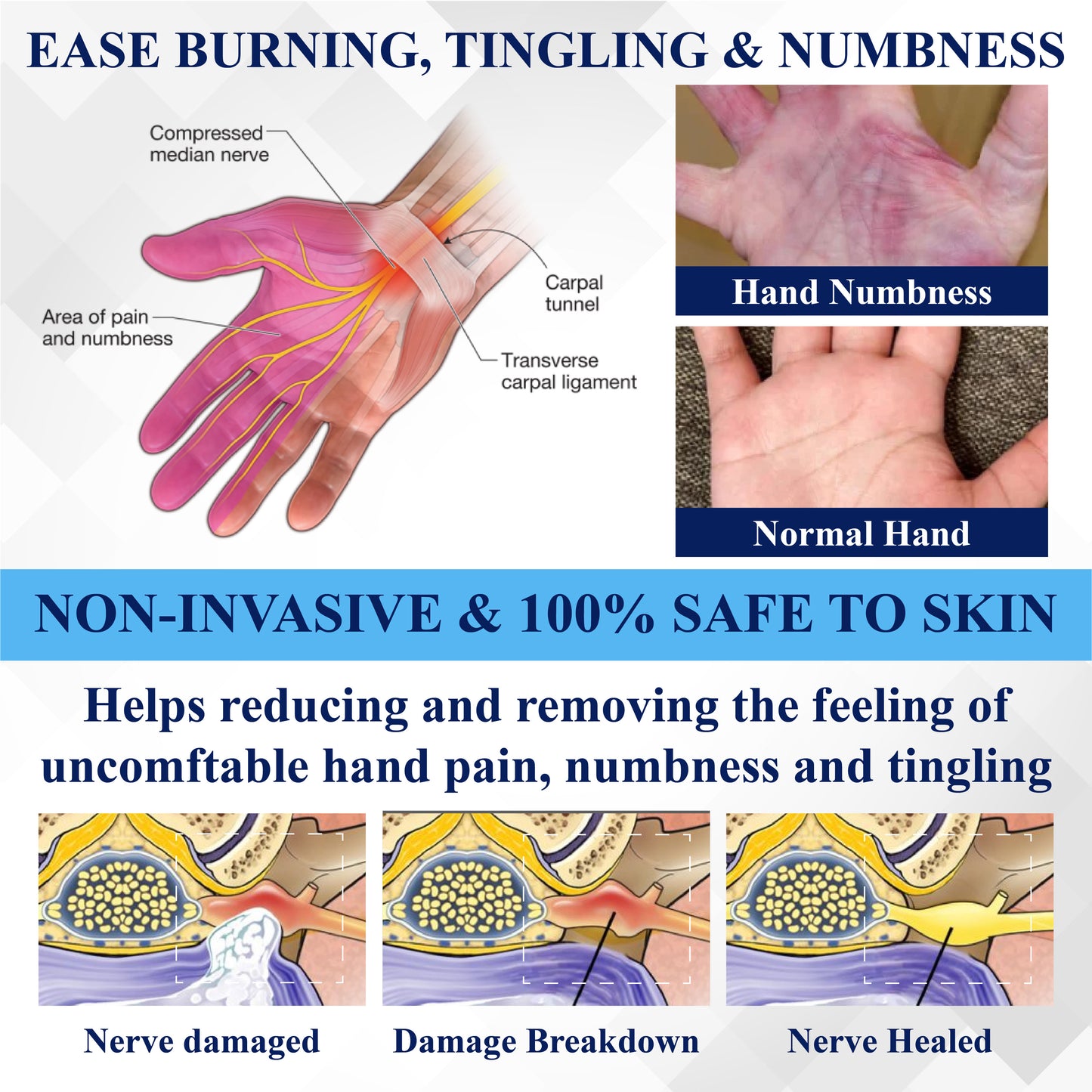 ATTDX® NerveRelief LC Medical Treatment Cream