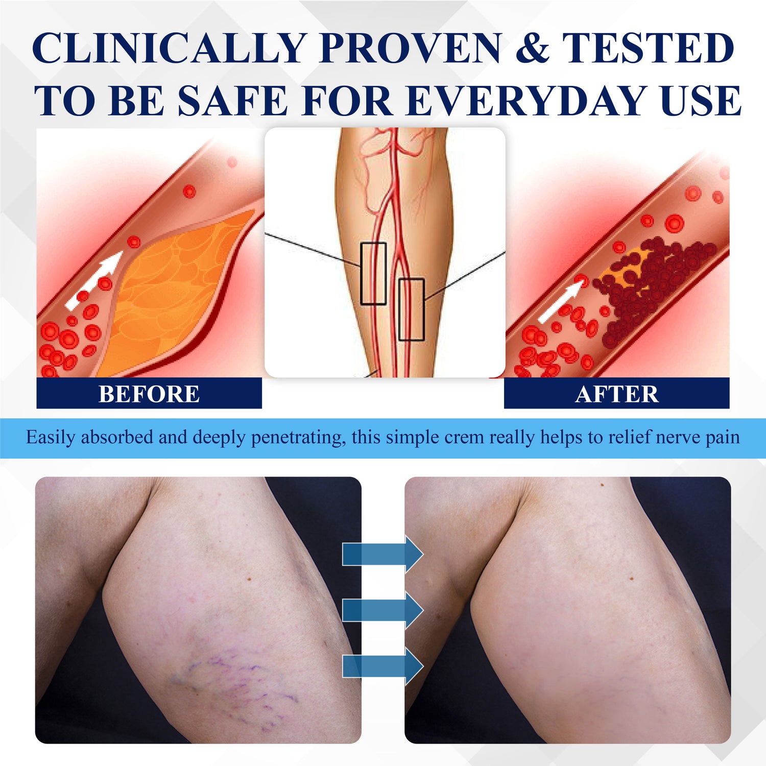 ATTDX® NerveRelief LC Medical Treatment Cream 22 ATTDX® NerveRelief LC Medical Treatment Cream