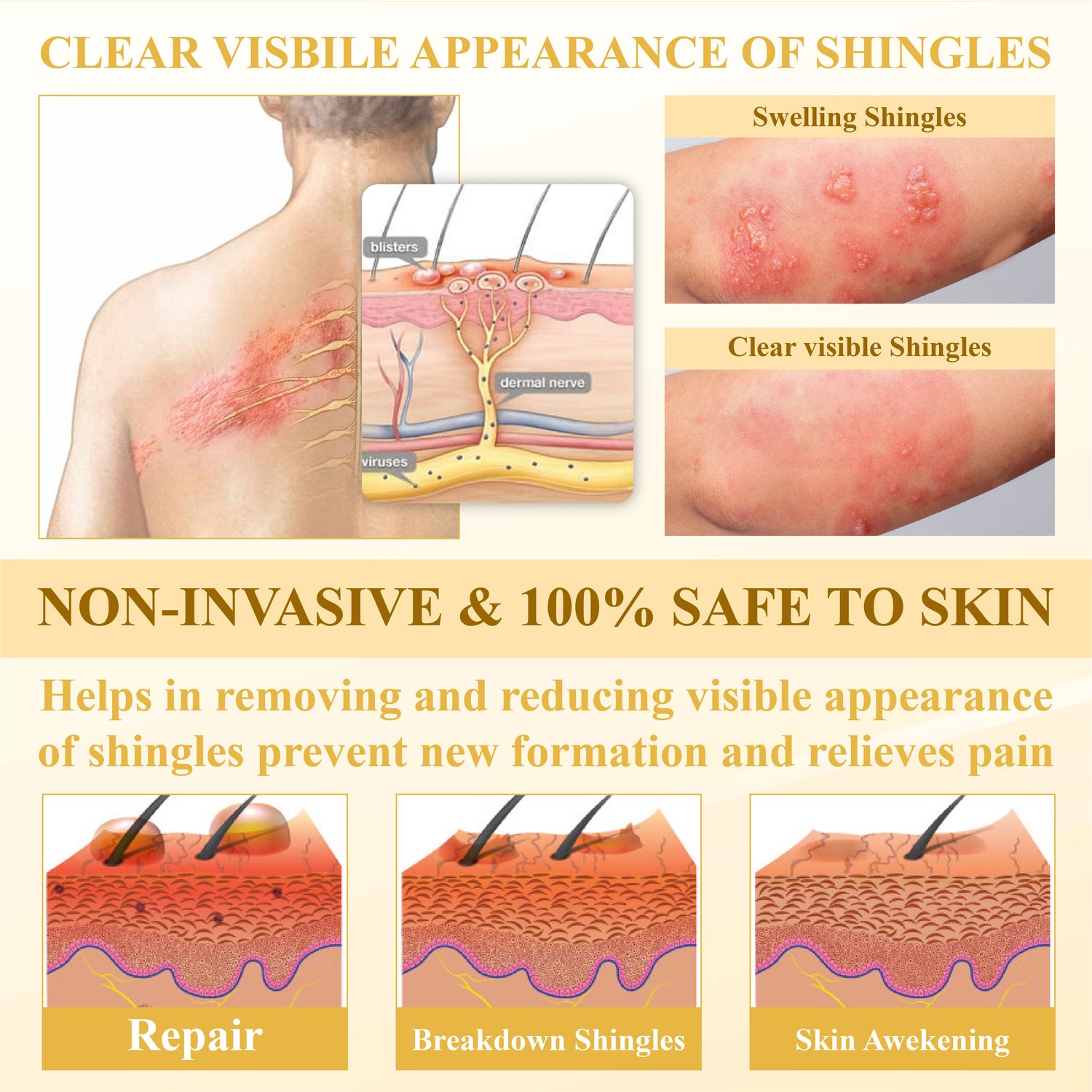 ATTDX® NervoSoothe Shingles Healing Ointment 24 ATTDX® NervoSoothe Shingles Healing Ointment