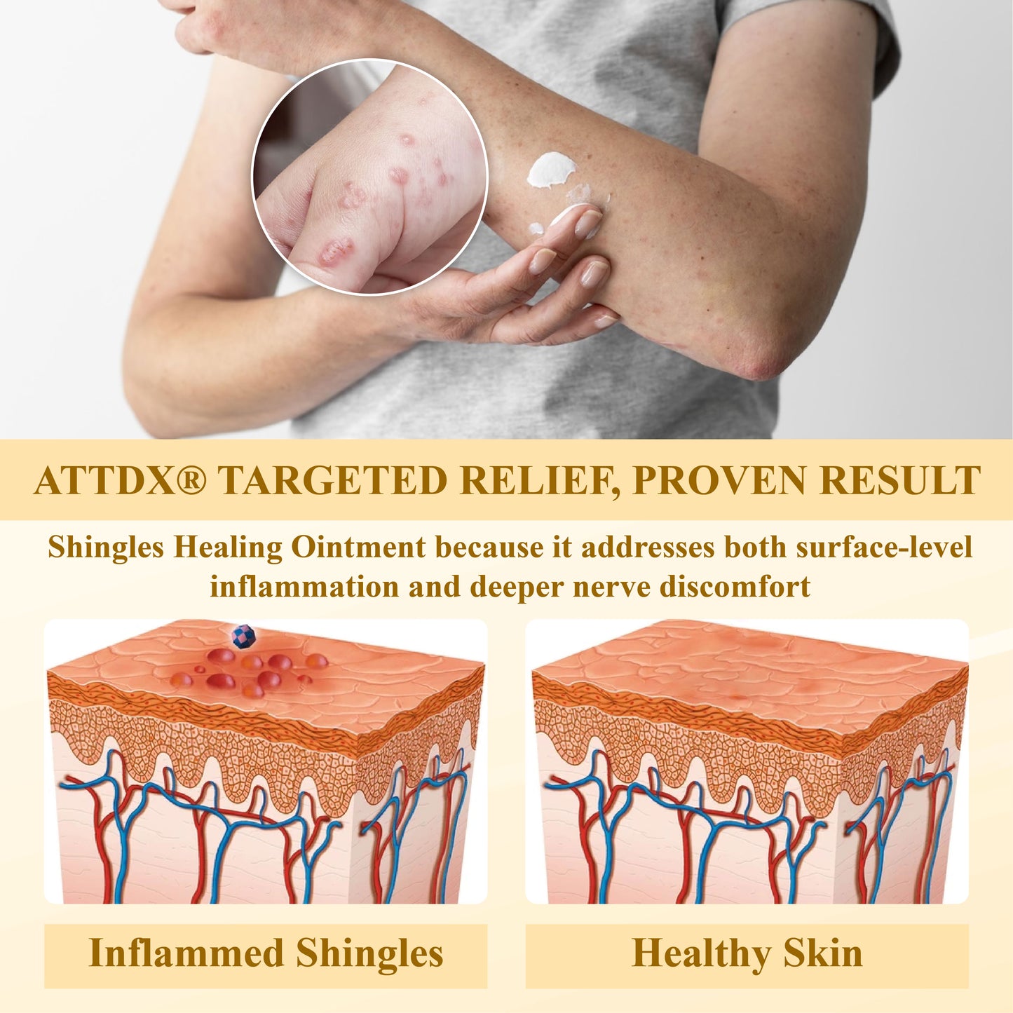 ATTDX® NervoSoothe Shingles Healing Ointment