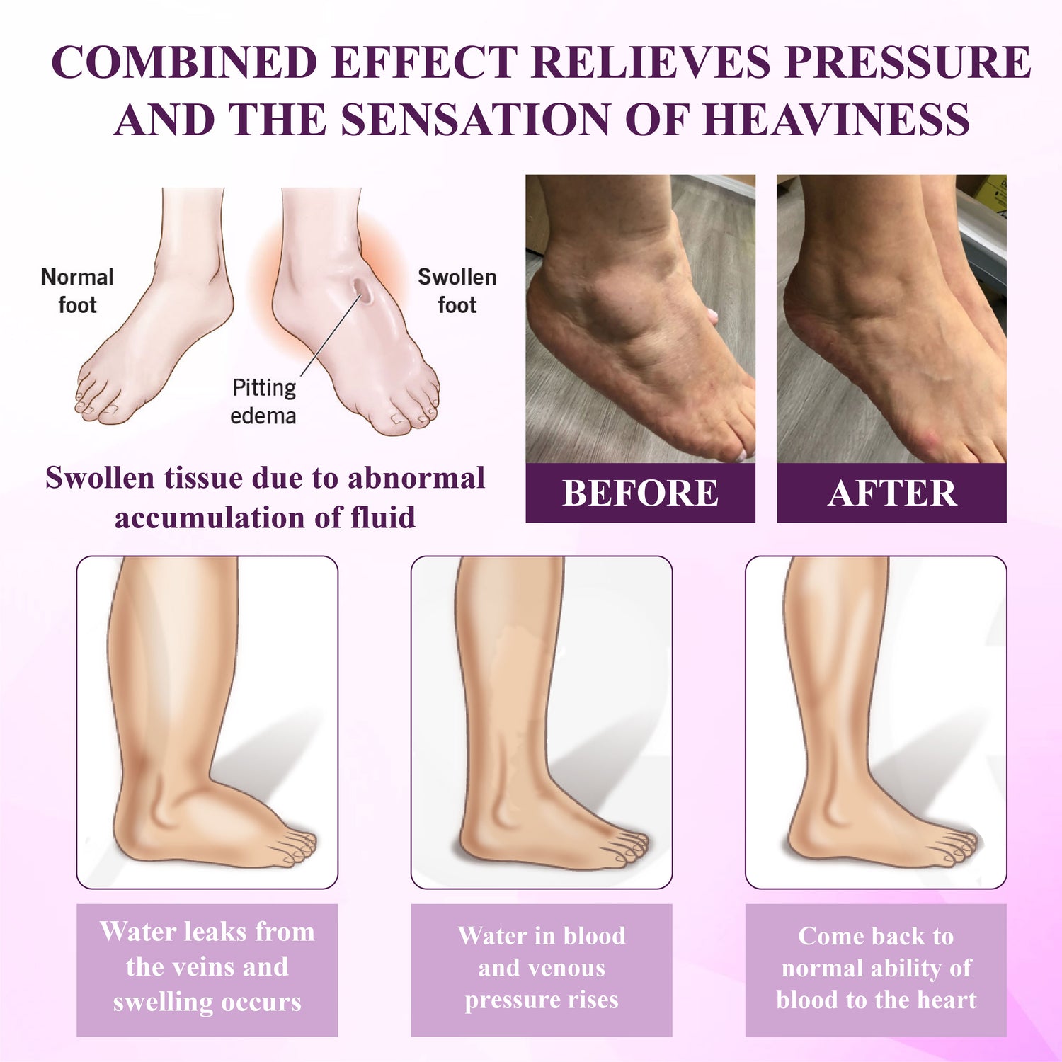 ATTDX® Night-Time Edema Relief Sleep Cream 26 ATTDX® Night-Time Edema Relief Sleep Cream