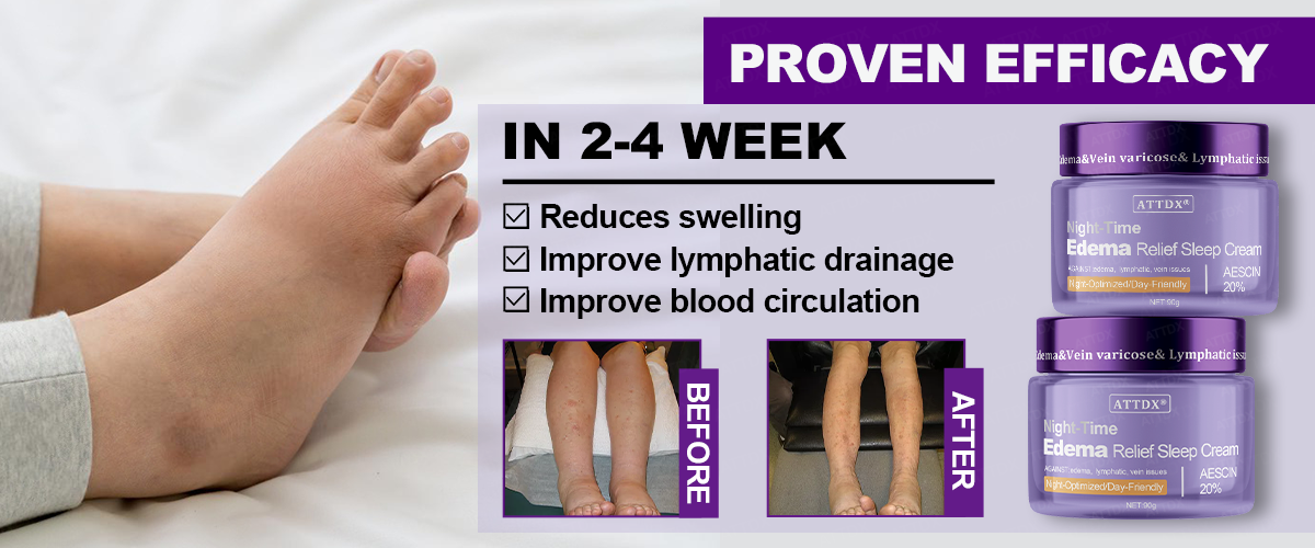 ATTDX® Night-Time Edema Relief Sleep Cream 24 ATTDX® Night-Time Edema Relief Sleep Cream